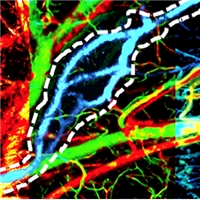 Optical Resolution Photoacoustic Microscopy Enables Simultaneous Multicontrast Imaging