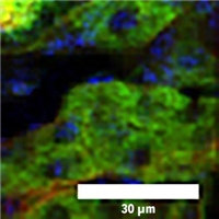 New Microscopy Technique Helps Acquire Finer Images of Deeper Tissue Rapidly